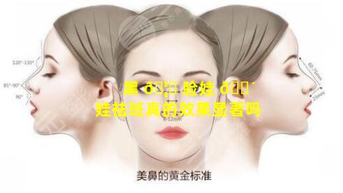 黑 🦈 脸娃 🐴 娃祛斑真的效果显著吗